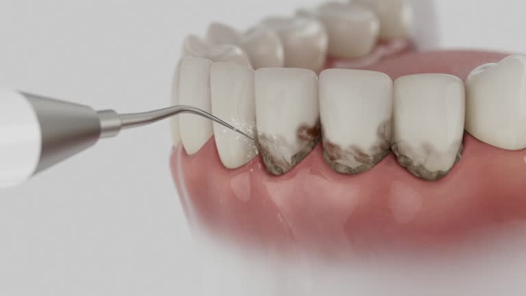 Reliable Dental contractor in Moses Lake North, WA by Dentist Open Now